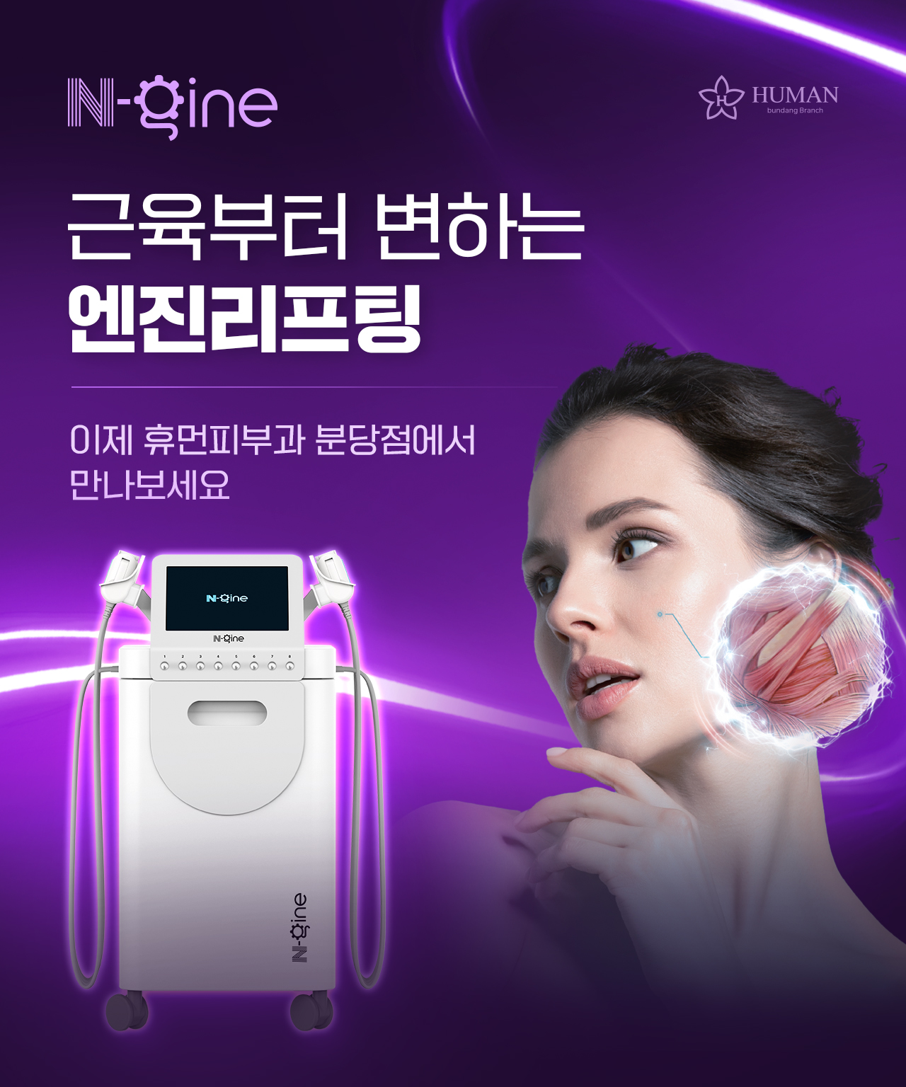 엔진리프팅